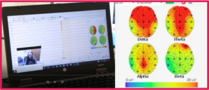 EEG results